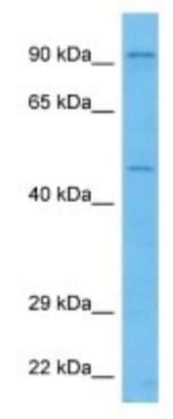 UST Rabbit anti-Mouse, Polyclonal, Novus Biologicals 100 &mu;g | Buy Online | Novus Biologicals | Fisher Scientific